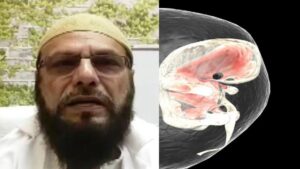 बच्चे में भ्रूण Jhuth Bole Kauva Kaate: गोबर के लपेटे में अखिलेश, हेराल्ड में सोनिया-राहुल