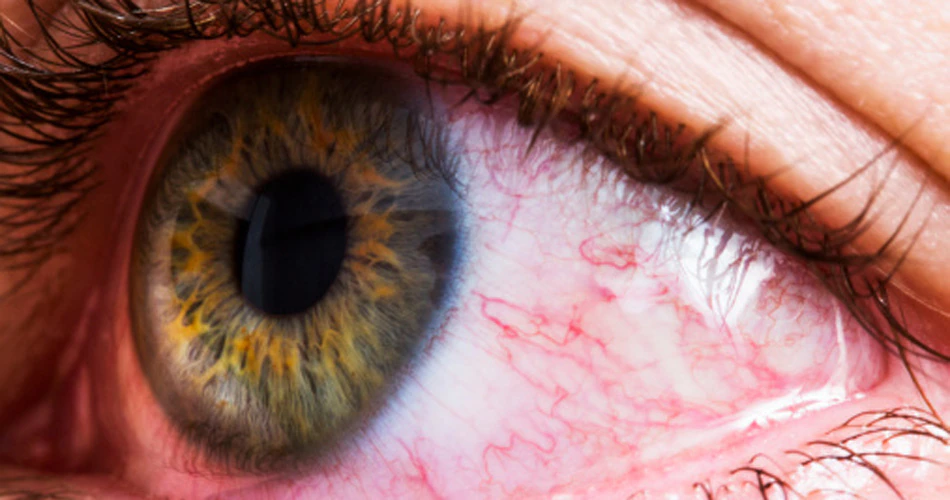 eye4_0