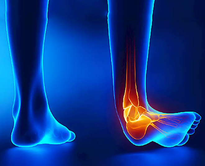 this-might-be-causing-pain-in-your-legs-MAin Uric Acid