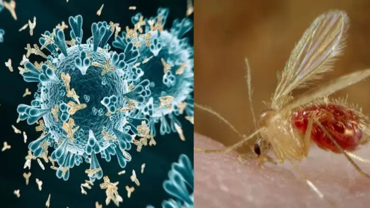 Chandipura Virus Infection Chandipura Virus Infection