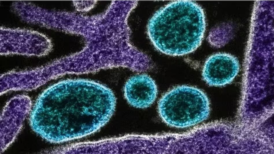 virus