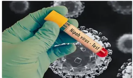 nipah-virus-1_V_jpg--442x260-4g Nipah Virus Alert