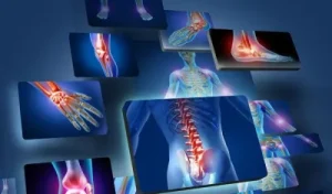 arth 1539338030 World Osteoarthritis Day 2024
