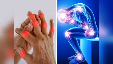 on-world-arthritis-day-orthopedic-surgeon-told-symptoms-causes-risk-factors-prevention-and-diet-plan-for-arthritis-94800062 World Osteoarthritis Day 2024