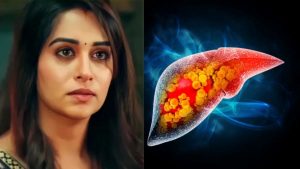 dipika kakar diagnosed with liver cancer1 1748406291