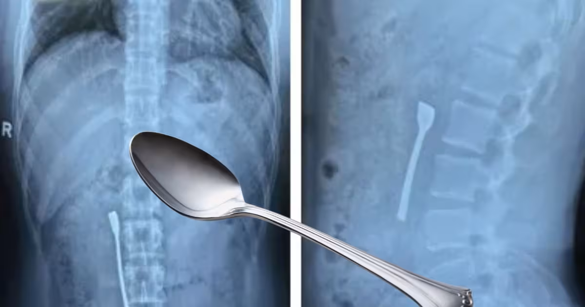Man-Swallowed-Spoon-2025-06-b4ed3fba4c7fa500b681be12ad33d4ea-16x9